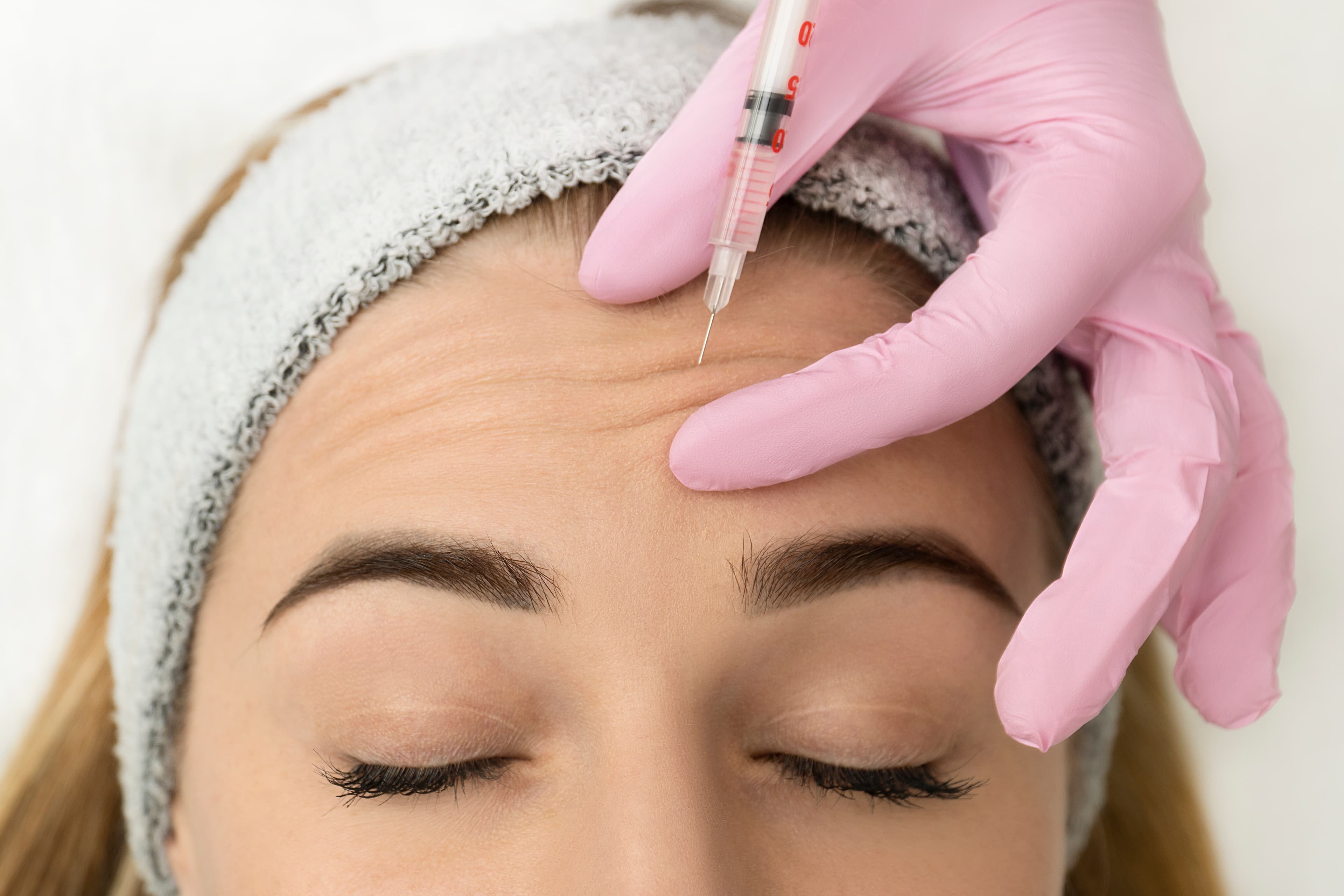 A provider injecting a neuromodulator into a patient's forehead