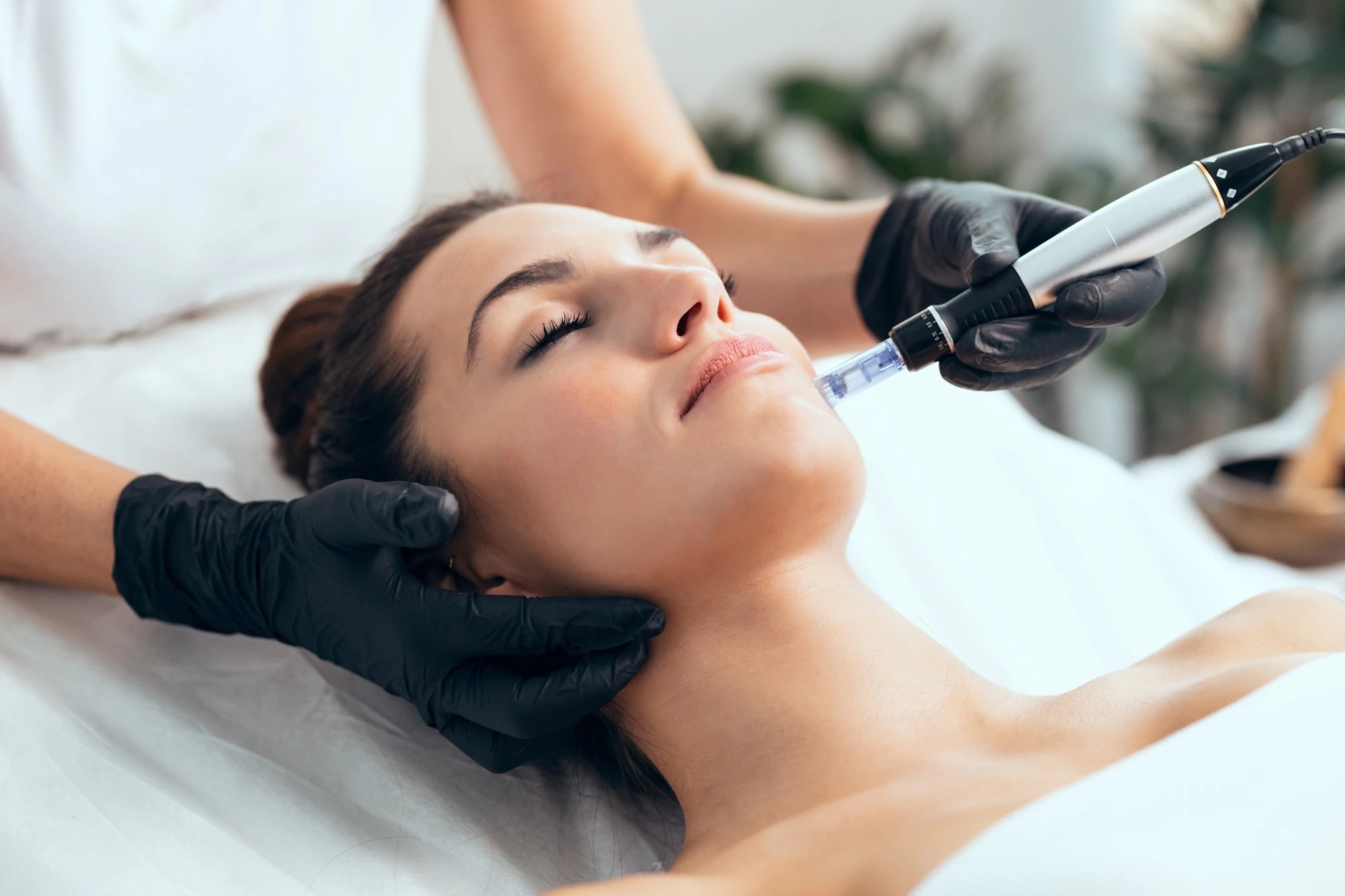 A woman lying back with her eyes closed while a provider in black gloves uses a microneedling pen on her jawline