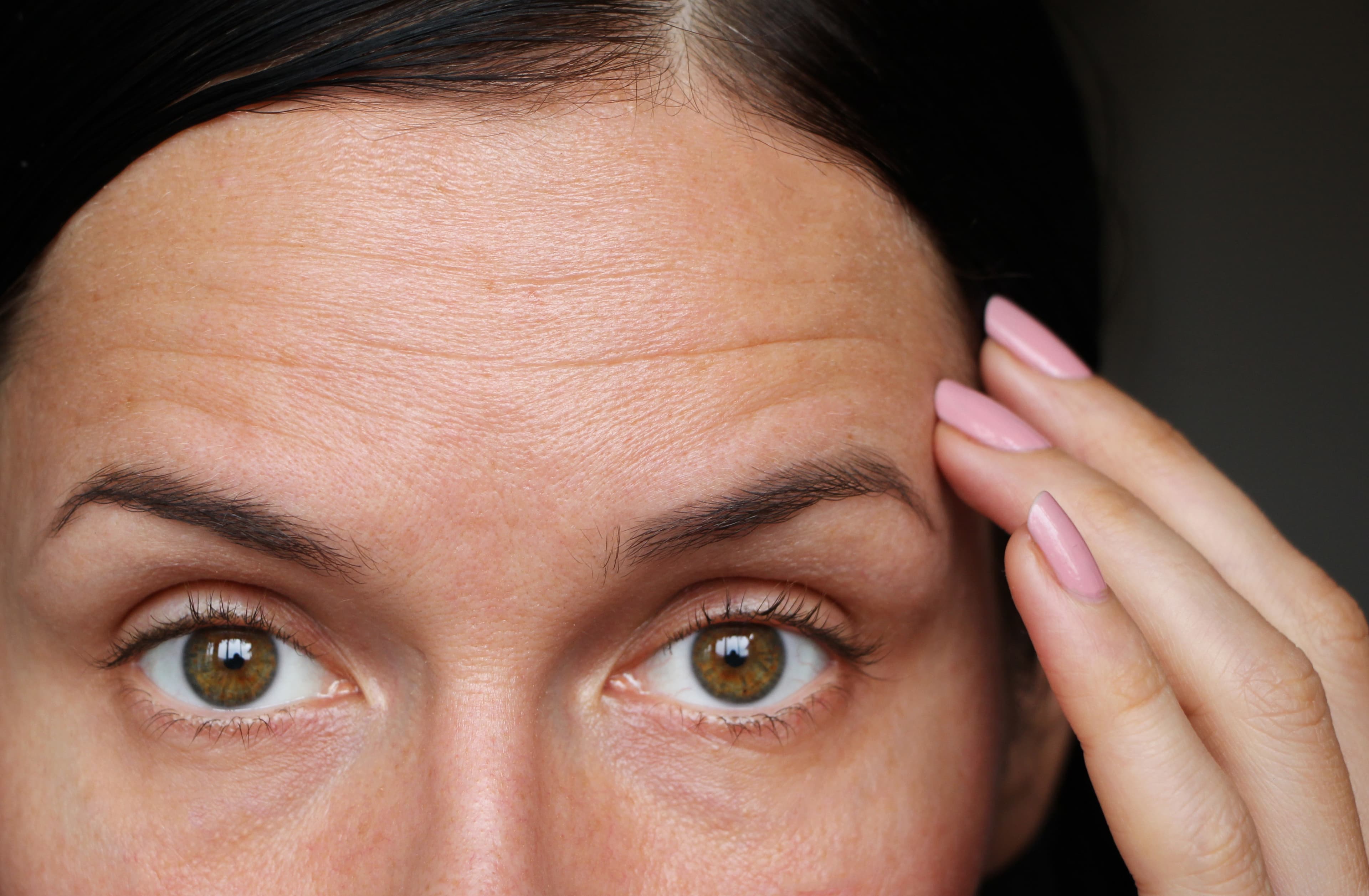 Close-up of a forehead showing fine lines and wrinkles